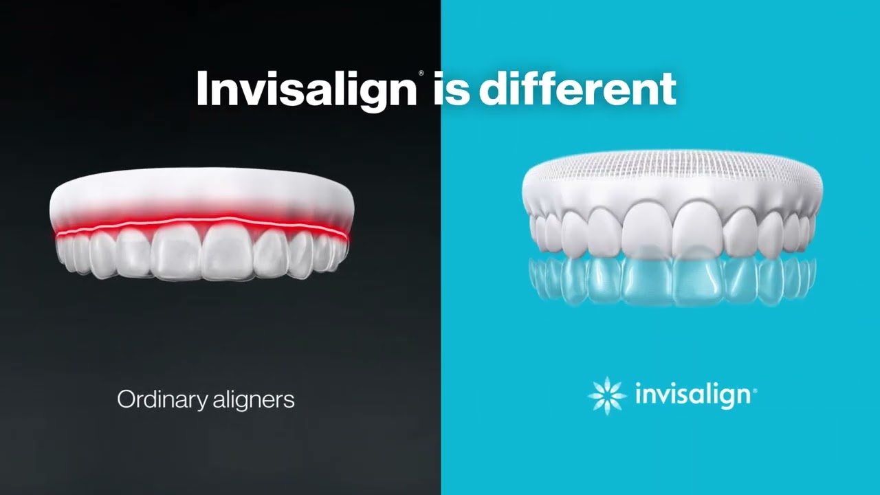 Invisalign SmartTrack vs ordinary aligners comparison