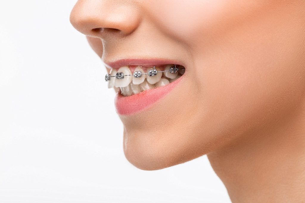 Orthodontics​